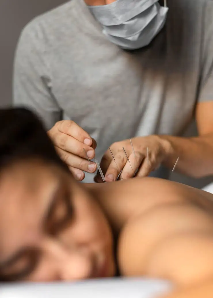 Acupuntura